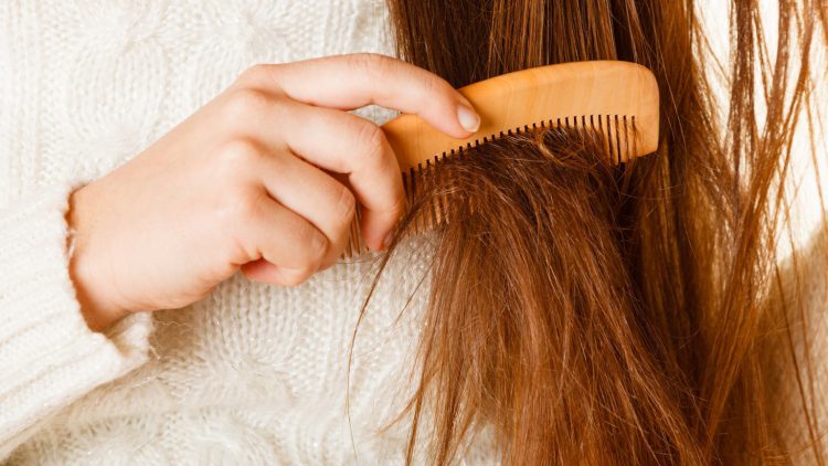 

  Estilizado de cabello – Los 10 peores errores


Estilizado de cabello – Los 10 peores errores